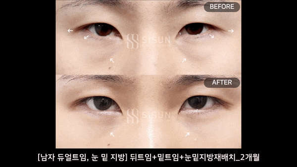 c6d67409ebb0372ec096ee66e89491fe_1745398025_4158.gif