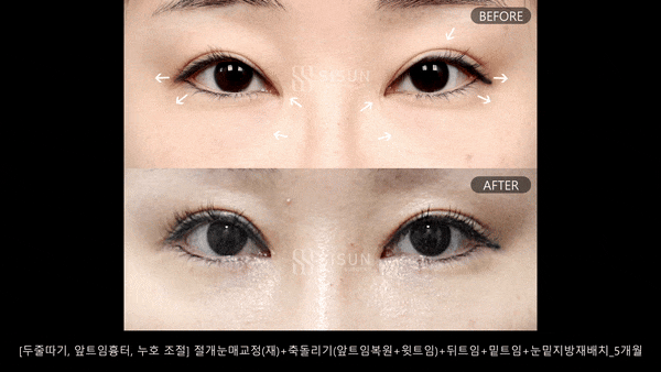 c6d67409ebb0372ec096ee66e89491fe_1745398056_2374.gif