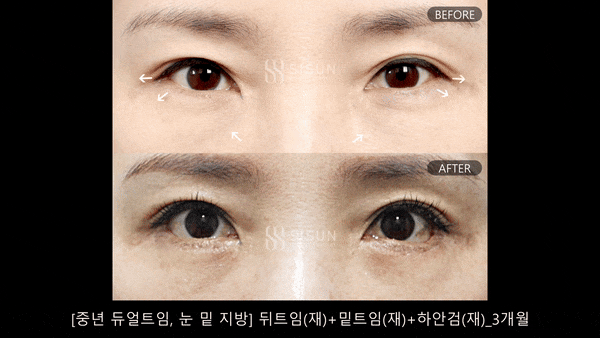 d8b3e41ecf3f57507090f5eba8a7335b_1745915488_0089.gif