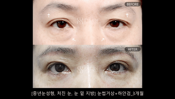 d8b3e41ecf3f57507090f5eba8a7335b_1745915490_4628.gif
