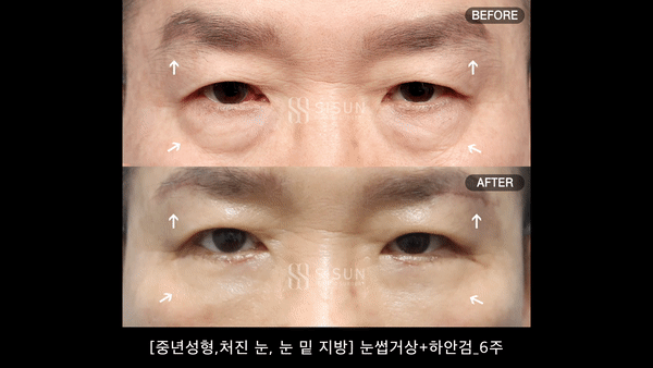 d8b3e41ecf3f57507090f5eba8a7335b_1745915737_5592.gif