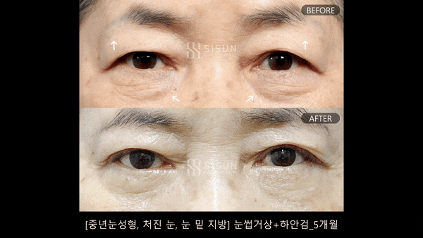 d8b3e41ecf3f57507090f5eba8a7335b_1745915753_4505.gif