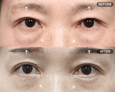 2c6dc538be7119400cc5a8c055e54850_1747383733_7789.gif