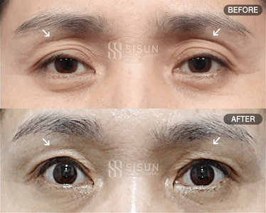 2c6dc538be7119400cc5a8c055e54850_1747383744_5165.gif