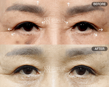 2c6dc538be7119400cc5a8c055e54850_1747383773_3822.gif