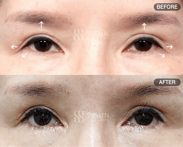2c6dc538be7119400cc5a8c055e54850_1747383780_2742.gif