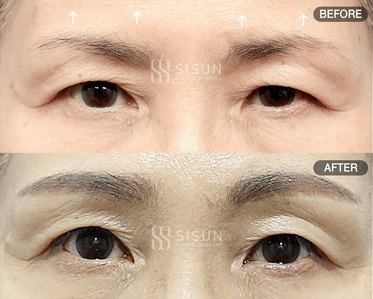 2c6dc538be7119400cc5a8c055e54850_1747383821_4656.gif