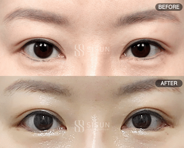 3a99746c46eb45b28ab60b581d0a8b19_1747731822_9891.gif