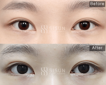 3a99746c46eb45b28ab60b581d0a8b19_1747731823_6378.gif