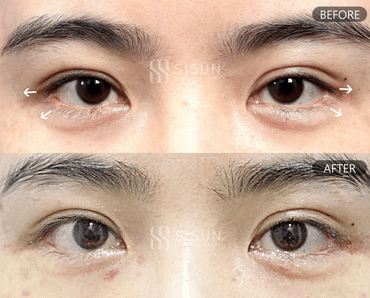 3a99746c46eb45b28ab60b581d0a8b19_1747731824_2153.gif