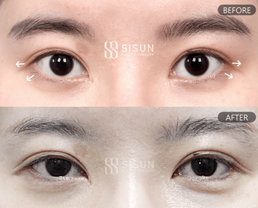 3a99746c46eb45b28ab60b581d0a8b19_1747820238_7817.gif