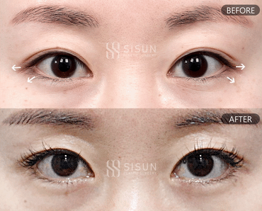 3a99746c46eb45b28ab60b581d0a8b19_1747820239_3357.gif