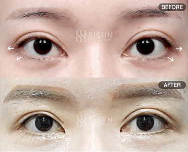 3a99746c46eb45b28ab60b581d0a8b19_1747820250_7073.gif