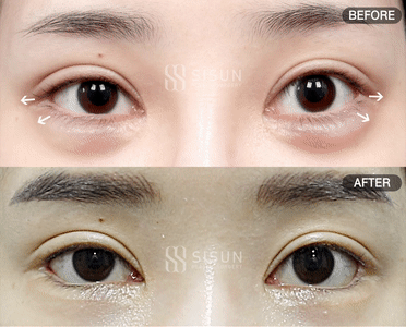 3a99746c46eb45b28ab60b581d0a8b19_1747820251_1563.gif