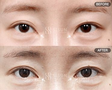 3a99746c46eb45b28ab60b581d0a8b19_1747820483_8646.gif