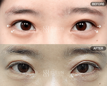 3a99746c46eb45b28ab60b581d0a8b19_1747820485_4603.gif