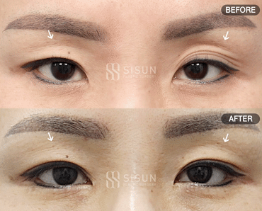 3a99746c46eb45b28ab60b581d0a8b19_1747902429_1602.gif