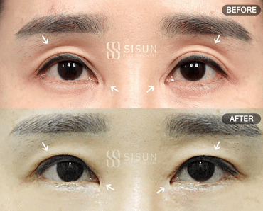 3a99746c46eb45b28ab60b581d0a8b19_1747902434_9528.gif