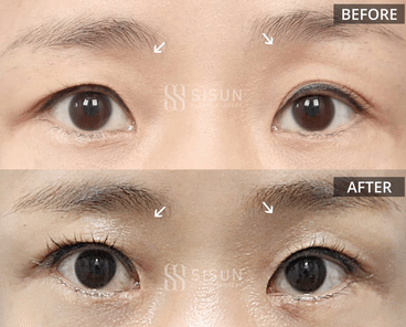 3a99746c46eb45b28ab60b581d0a8b19_1747902437_1657.gif