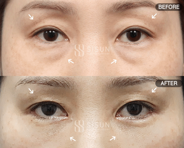 3a99746c46eb45b28ab60b581d0a8b19_1747902438_686.gif
