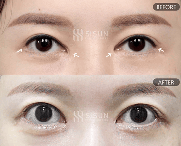 3a99746c46eb45b28ab60b581d0a8b19_1747992581_5502.gif