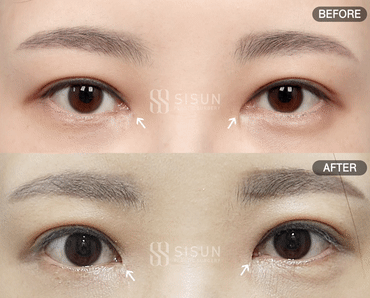 3a99746c46eb45b28ab60b581d0a8b19_1747992585_2785.gif