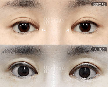 3a99746c46eb45b28ab60b581d0a8b19_1747992587_1169.gif