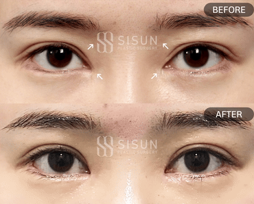 3a99746c46eb45b28ab60b581d0a8b19_1747992805_3983.gif