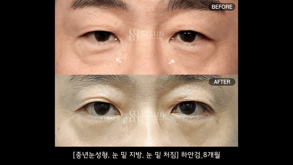 3a99746c46eb45b28ab60b581d0a8b19_1748251433_4383.gif