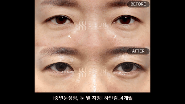 3a99746c46eb45b28ab60b581d0a8b19_1748251436_2646.gif