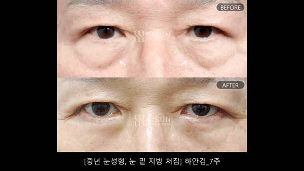 3a99746c46eb45b28ab60b581d0a8b19_1748251440_2403.gif
