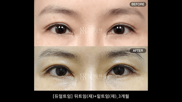 3a99746c46eb45b28ab60b581d0a8b19_1748330219_2081.gif
