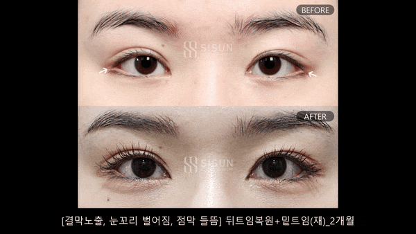 3a99746c46eb45b28ab60b581d0a8b19_1748330224_9099.gif