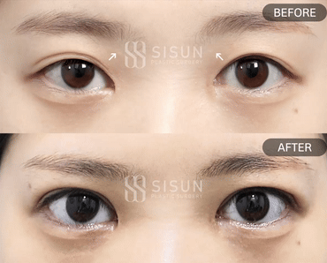 3a99746c46eb45b28ab60b581d0a8b19_1748505851_076.gif