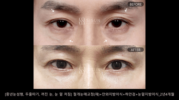 3a99746c46eb45b28ab60b581d0a8b19_1748577707_6733.gif