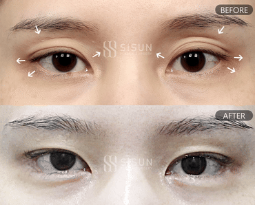 552a2bbff1b06415dc7e5da6eb72c950_1747302062_0586.gif