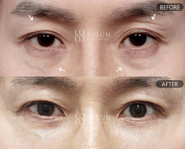552a2bbff1b06415dc7e5da6eb72c950_1747302076_1146.gif
