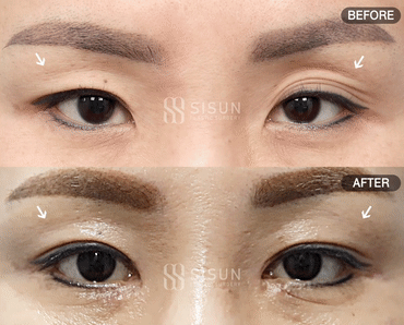 552a2bbff1b06415dc7e5da6eb72c950_1747302093_0008.gif