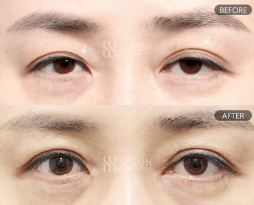 552a2bbff1b06415dc7e5da6eb72c950_1747302740_9809.gif