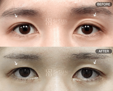 552a2bbff1b06415dc7e5da6eb72c950_1747302760_6308.gif