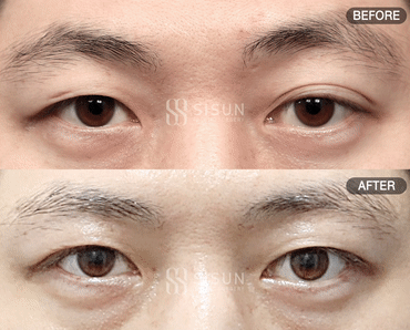 552a2bbff1b06415dc7e5da6eb72c950_1747302764_0444.gif
