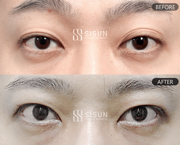 552a2bbff1b06415dc7e5da6eb72c950_1747302766_7929.gif