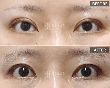 552a2bbff1b06415dc7e5da6eb72c950_1747385700_2509.gif