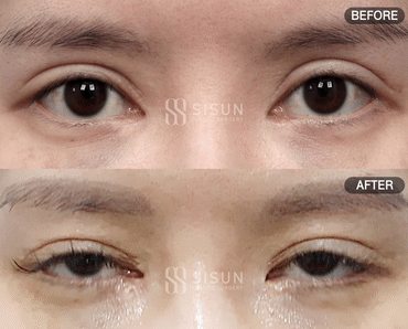 552a2bbff1b06415dc7e5da6eb72c950_1747385701_5659.gif