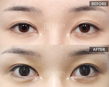 552a2bbff1b06415dc7e5da6eb72c950_1747385706_2114.gif