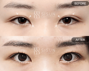 552a2bbff1b06415dc7e5da6eb72c950_1747385707_1812.gif