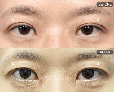 552a2bbff1b06415dc7e5da6eb72c950_1747385718_5883.gif