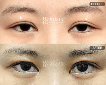 552a2bbff1b06415dc7e5da6eb72c950_1747385721_1234.gif