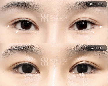 5907d22c9380bcc761f16bbcab79dd7d_1748245853_5516.gif