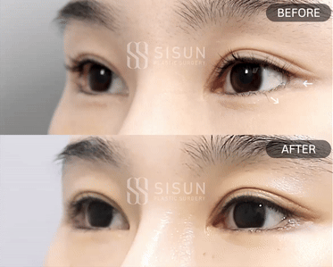 5907d22c9380bcc761f16bbcab79dd7d_1748245876_2602.gif